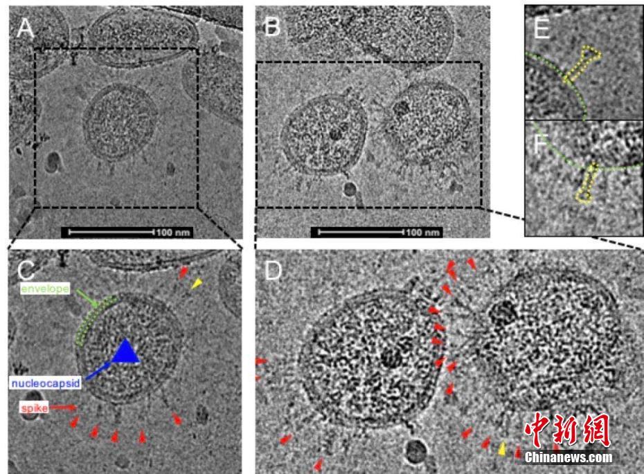 深圳科研团队首次描绘灭活新冠病毒真实形貌