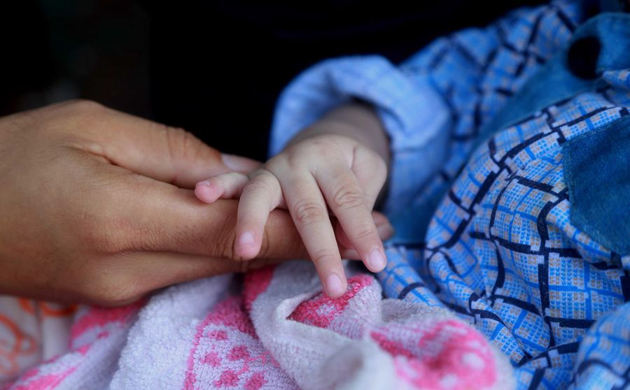 双胞胎同患重病成"外星人" 吓跑妈妈