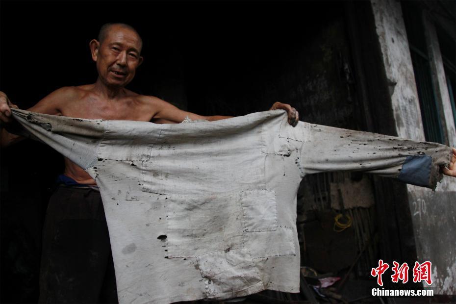老人展示被铁水飞溅上去后烫坏的衣服.钟欣摄