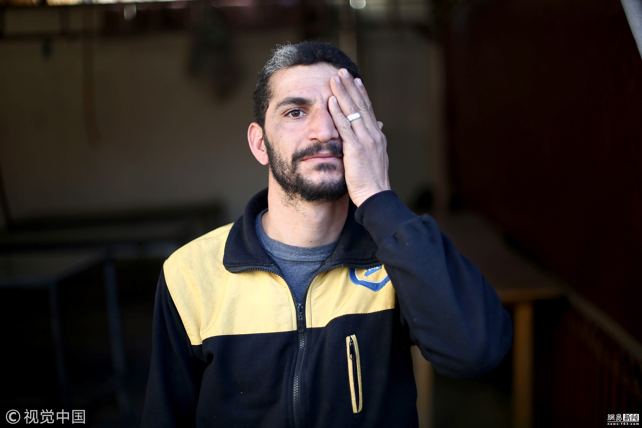 叙利亚战争群像:声援失去眼睛的孩子